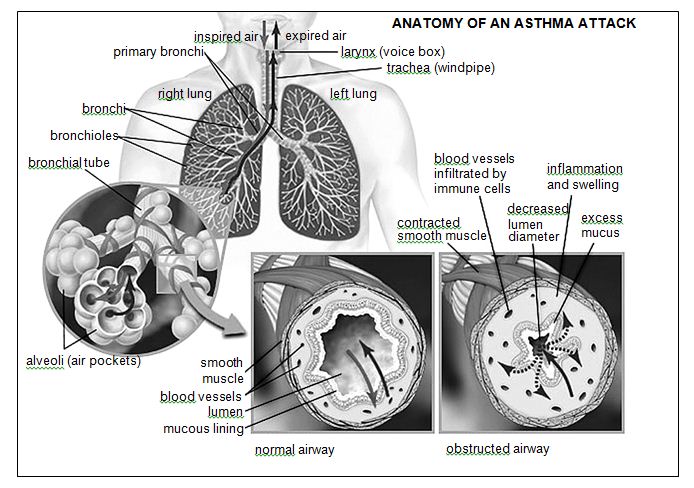 Approach & Methodology In Drug Dependant Asthma (Broncho-Spasm) Cases